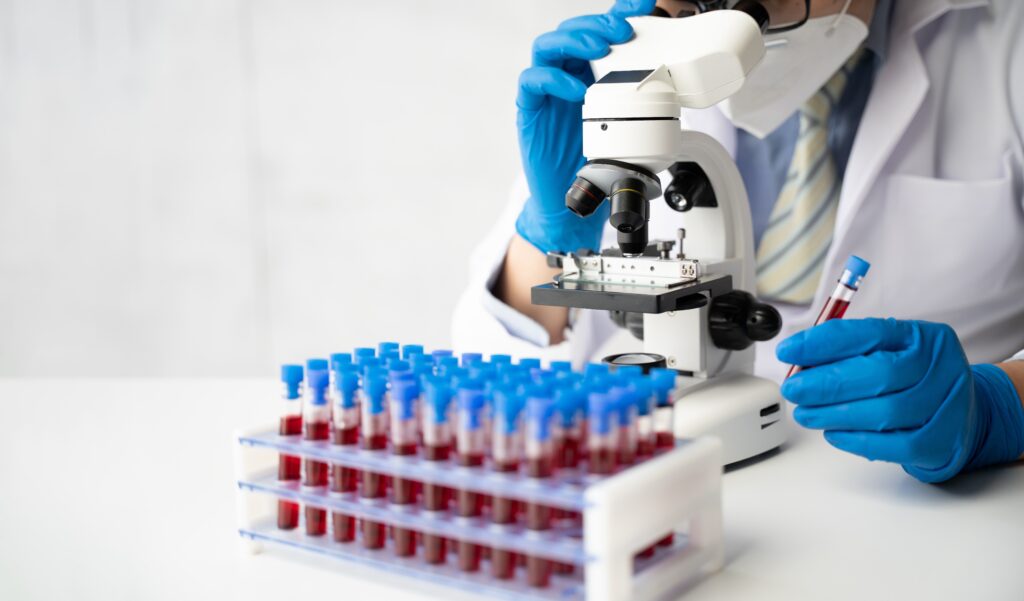 Scientists Create First Accurate Blood Test for Chronic Fatigue Syndrome